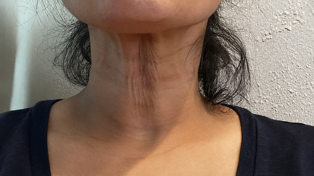 Close-up of a woman in her 40s showing visible crepey neck skin and fine lines associated with aging.
